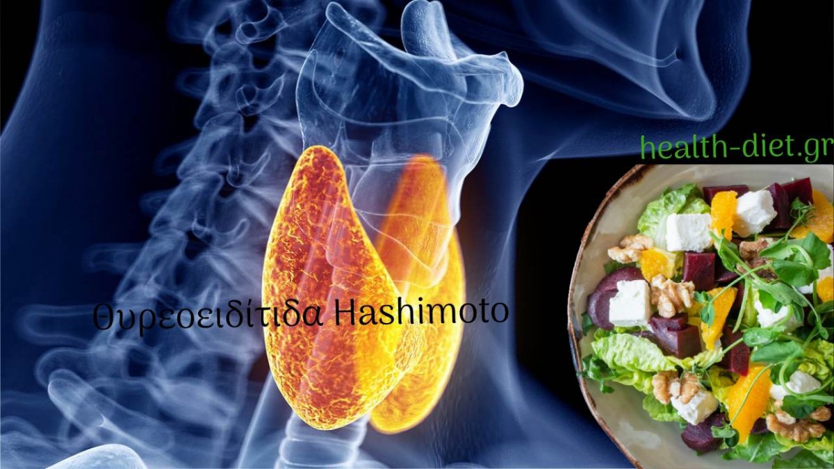 Τι είναι η Θυρεοειδίτιδα Hashimoto και πώς Επιδρά η Διατροφή